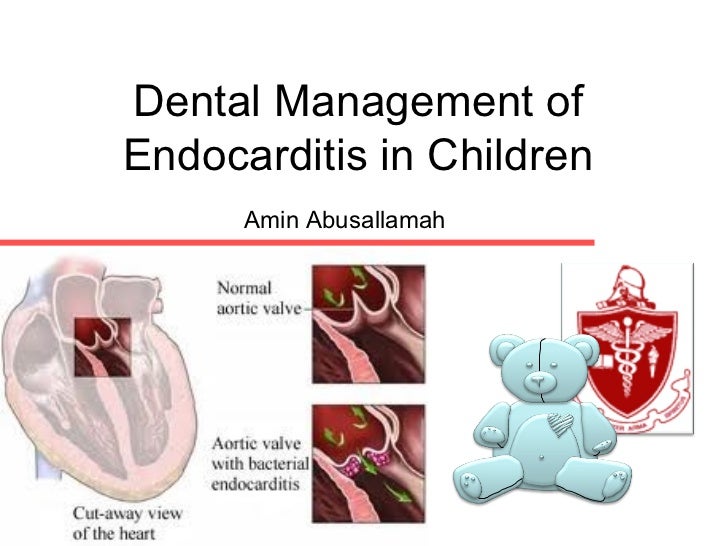 Dental management of endocarditis in children
