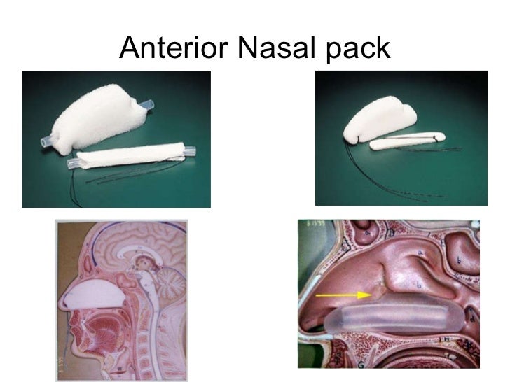 Dental Presentation E.N.T.