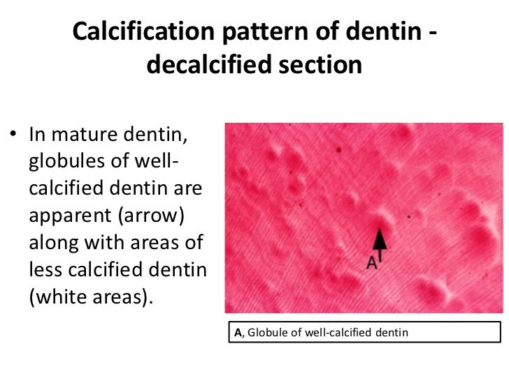 Dentin