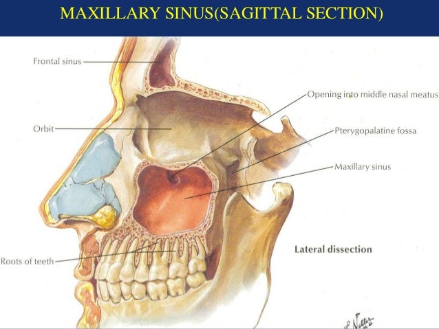 Dentist in pune.(BDS. MDS) - Dr. Amit T. Suryawanshi. Nose & Paranasa…