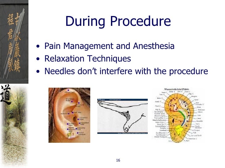 Dentistry And Acupuncture