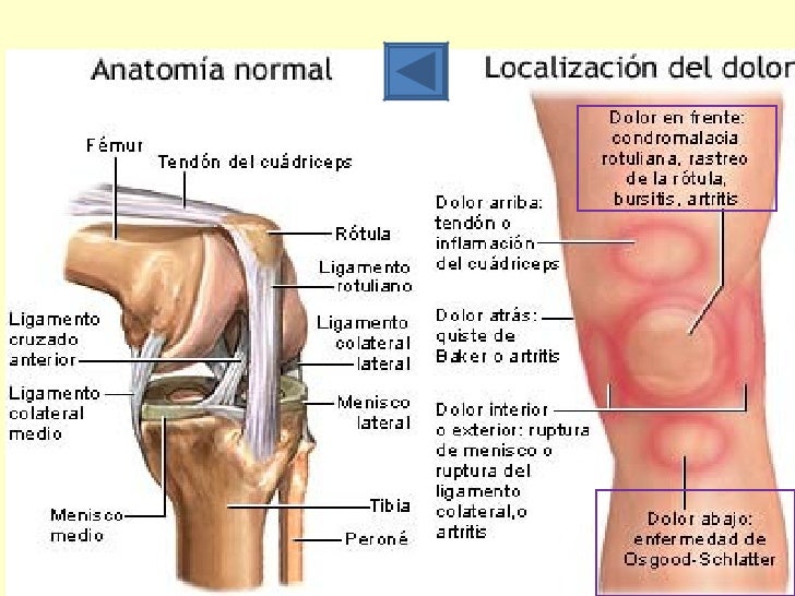 Inflamacion del cartilago de la rodilla