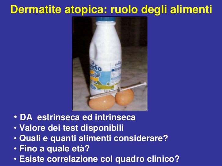 Psoriasi di fotografia di malattia stadio iniziale