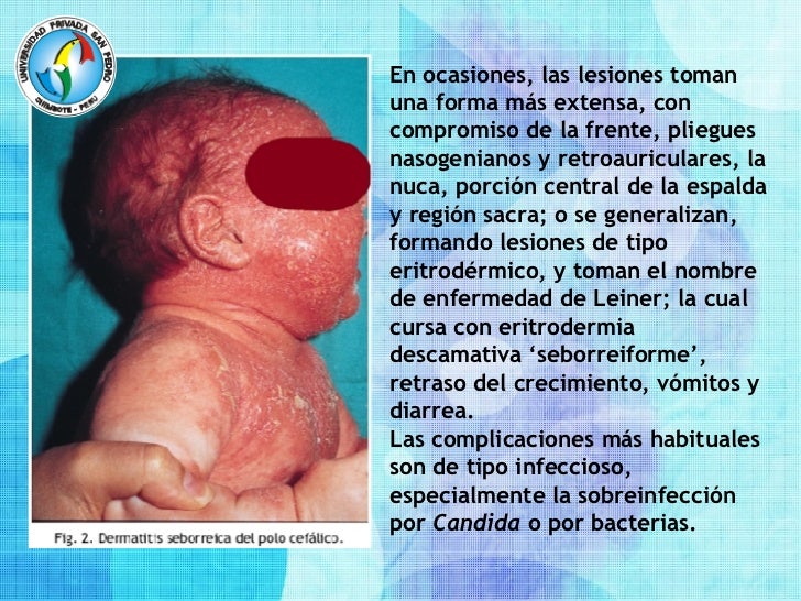 Los dolores con la espalda en el departamento de pecho de la columna vertebral