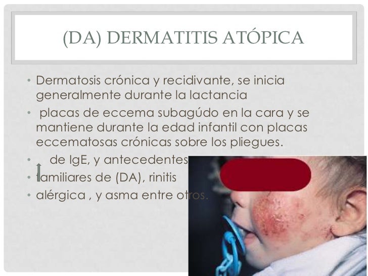 Si pasa la psoriasis a otra persona