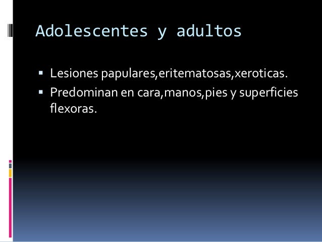 El aceite alcanforado y la psoriasis
