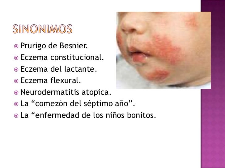 Comprar el ungüento chino de la psoriasis el rey de la piel