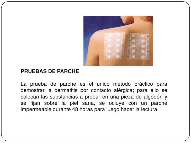 Como curar la eccema en las manos durante el embarazo