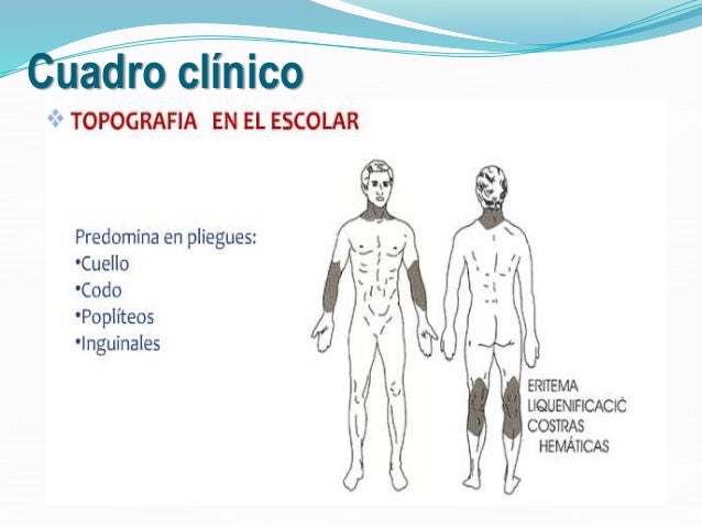 En que farmacia comprar la crema la cera es sano de la psoriasis