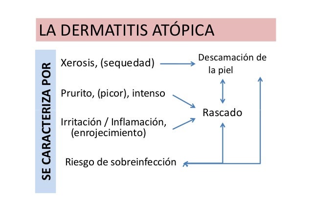 El médico por atopicheskomu a la dermatitis