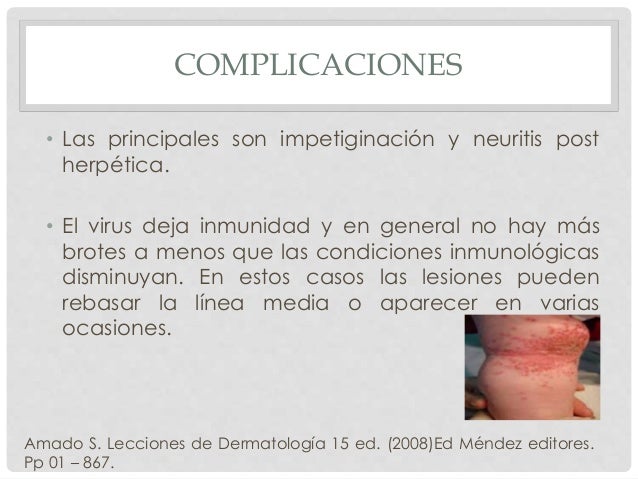 La psoriasis de las uñas por el vinagre