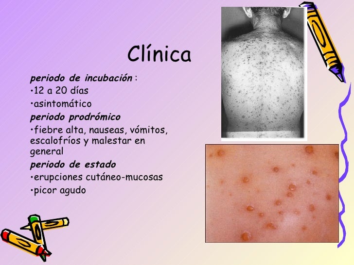 Que curar la psoriasis los ungüentos hormónicos