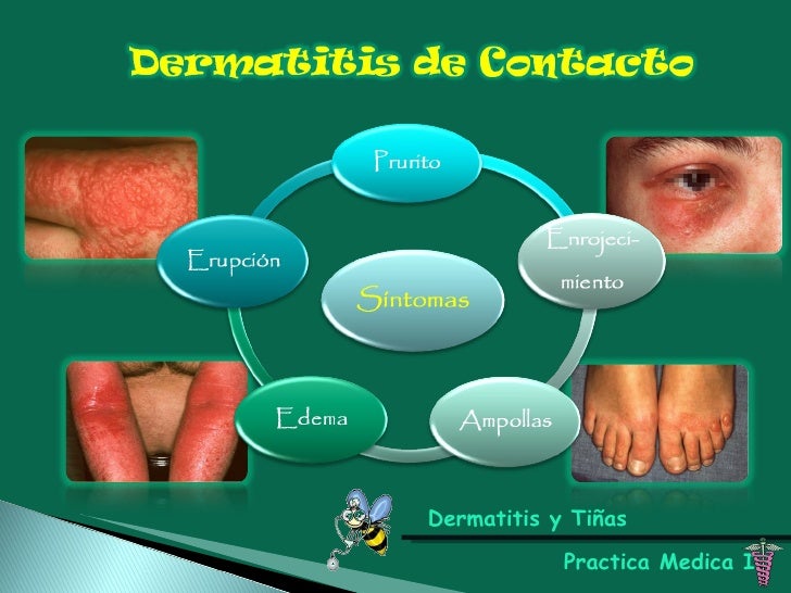 Que cura realmente la psoriasis