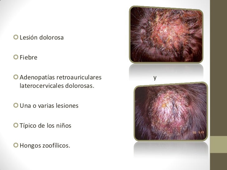 Si es posible usar ekzoderil a la lactación
