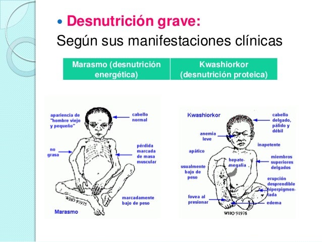 Dieta para perder grasa y ganar musculo para mujeres Comida juega dieta para perder grasa y ganar musculo para mujeres hicieron prueba