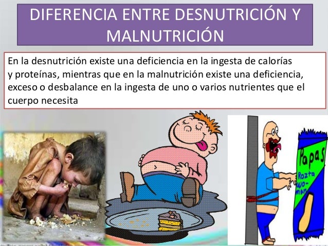 Desnutricion Desnutricion