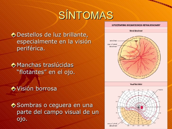 Retina Slide Related Keywords & Suggestions - Retina Slide Retina Slide Related Keywords & Suggestions - Retina Slide