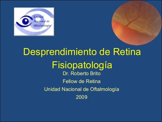Desprendimiento de retina Desprendimiento de retina