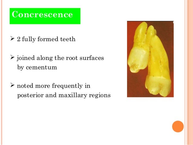 lateral incisor
