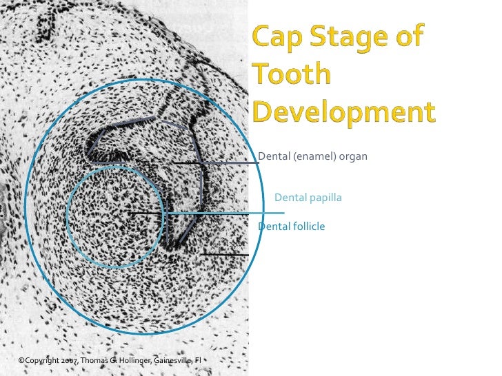 Development Of Dentition & Occlusion