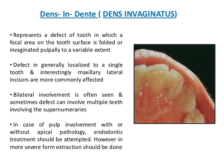 Development of tooth