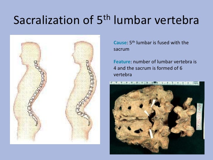 Development Of Vertebral Column