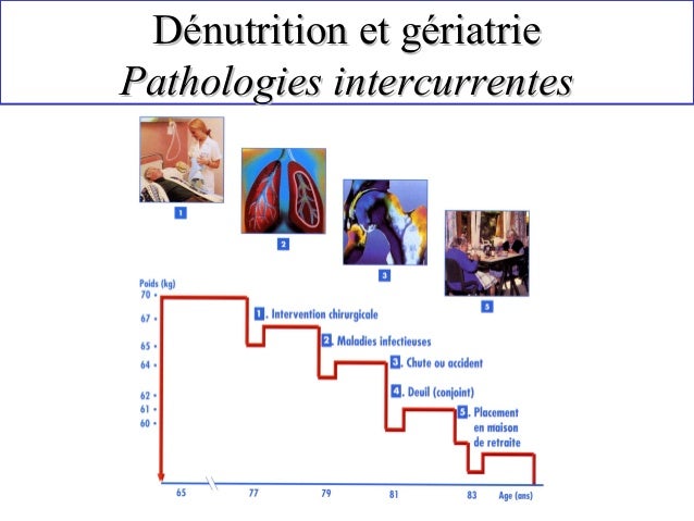 Most cancers Du Pancreas Perte De Poids