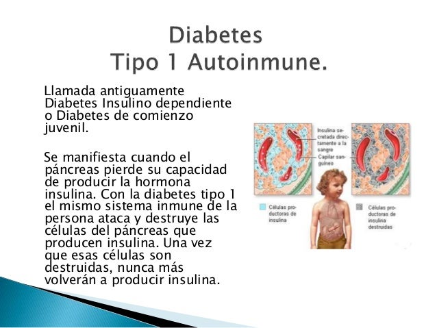 ... diabetes insulino dependiente o diabetes de comienzo juvenil