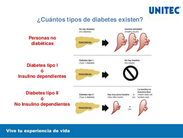 ¿Qué es la Nefropatía Diabética? ¿Qué es la Nefropatía Diabética?