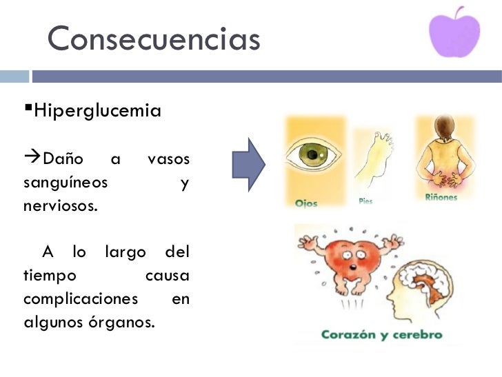 Diabetes Mellitus, realizada por Lilian Contreras C. Diabetes Mellitus, realizada por Lilian Contreras C.