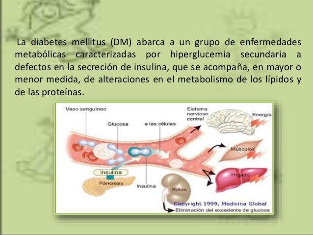 Diabetes mellitus tipo1 Diabetes mellitus tipo1