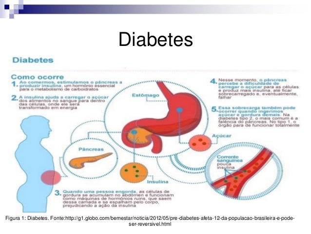 Diabetes tipo 1 tipo 2 e gestacional Diabetes tipo 1 tipo 2 e gestacional