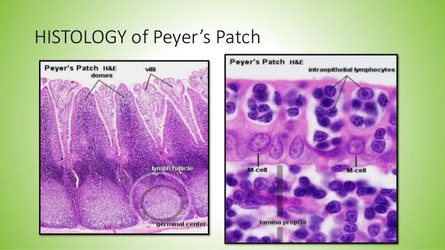 M Cell Peyer`S Patch