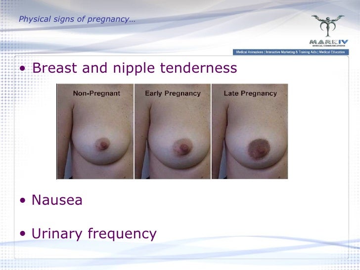Nipples When Pregnant 111