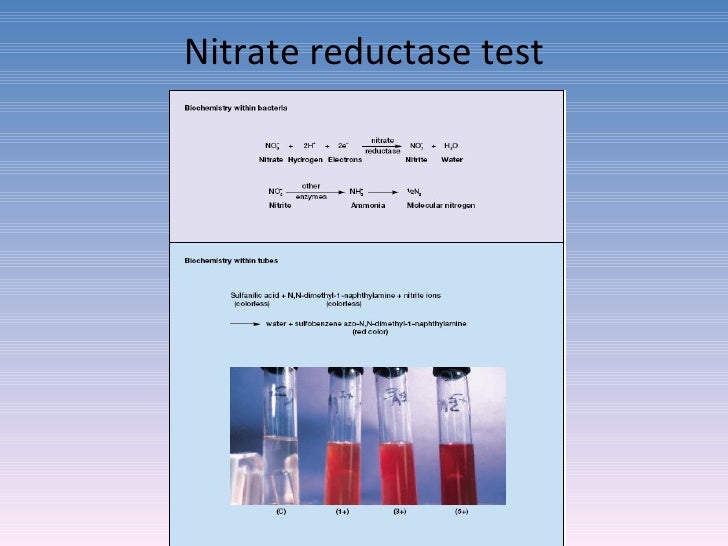 Diagnostic microbiology Traditional and Modern Approach