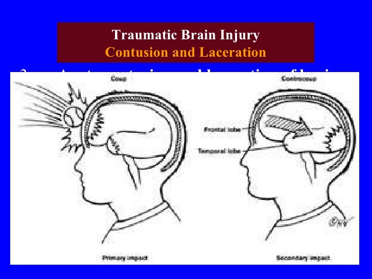 Diagnostic Neuroradiology