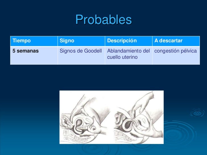 Diagnostico de embarazo sandy