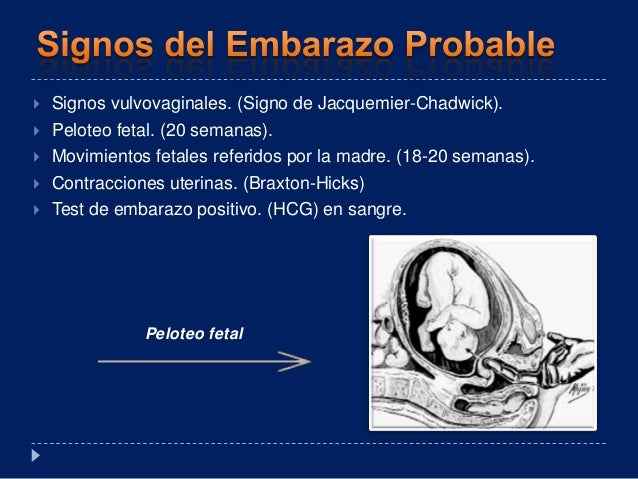 Signo De Jacquemier Chadwick Johnson es.slideshare.net