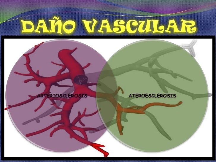Diagnostico de hipertension arterial Diagnostico de hipertension arterial