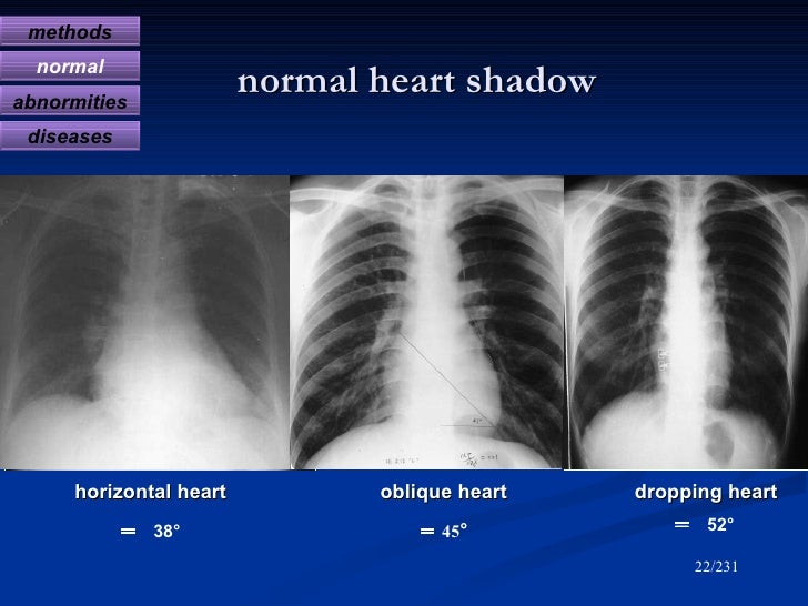 Diagnostic radiology of cardiovascular 2009