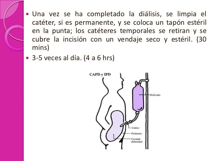 Dialisis