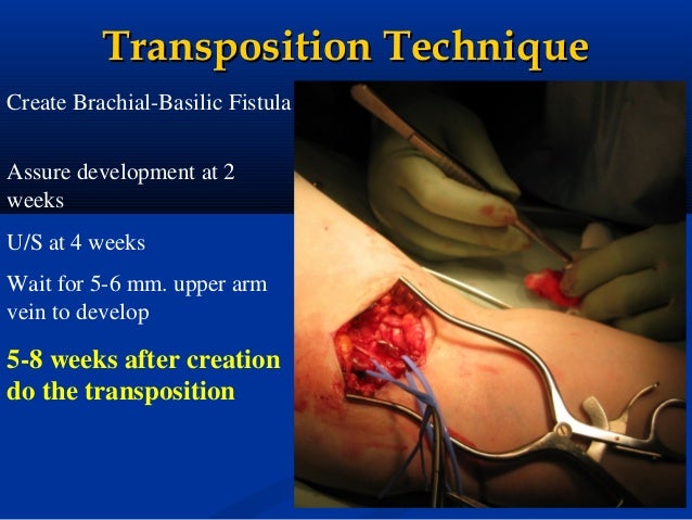 Fresenius dialysis facilities in europe renal dialysis facility manual