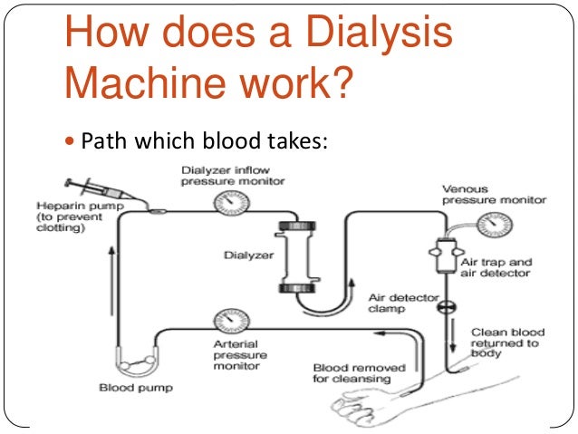 dialysis-machine-2