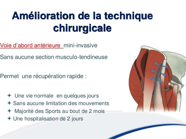Comme augmenter le membre sexuel par les moyens simples