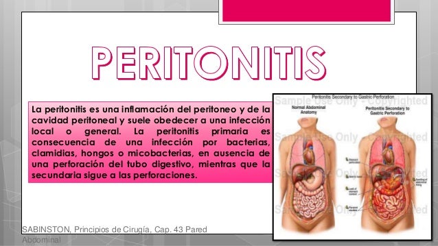 Los dolores en los riñones que se da en los pies