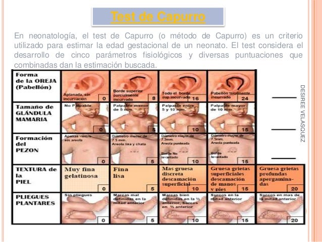 test de capurro en el recien nacido pdf