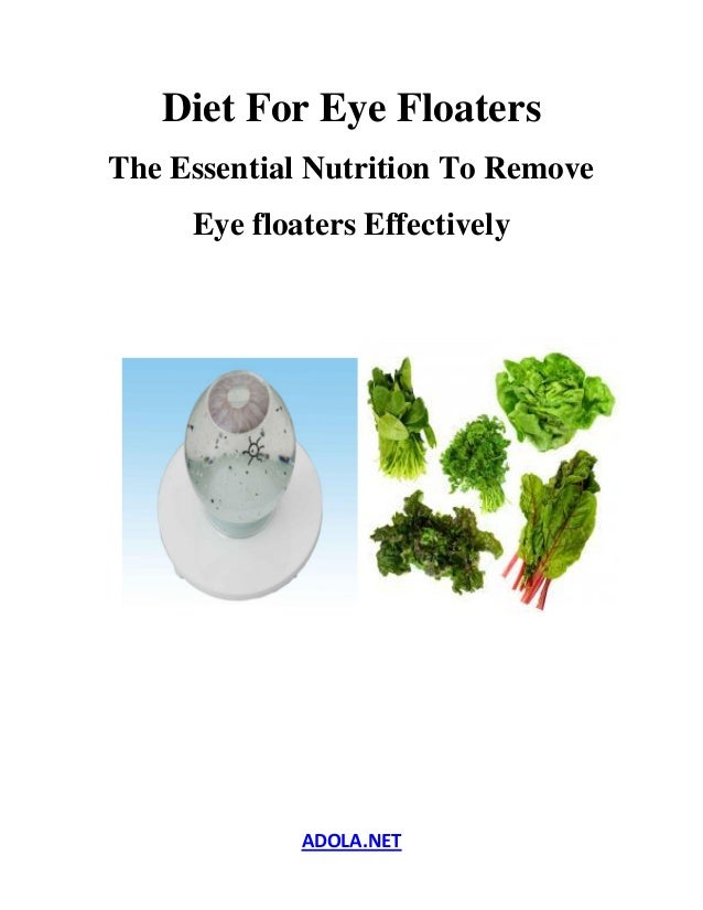  Floaters - The Essential Nutrition To Remove Eye floaters Effectively