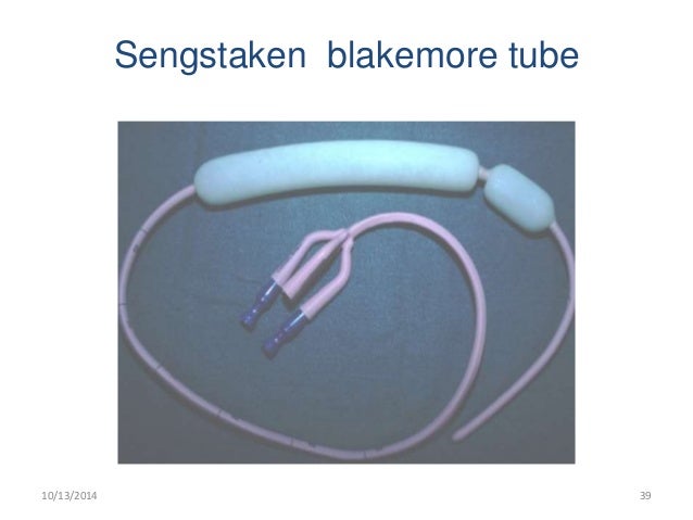 sengstaken blakemore tube