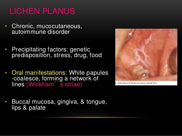 Oral Cancer Genetic Predisposition