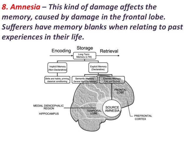 types of amnesia brain injury types of amnesia brain injury